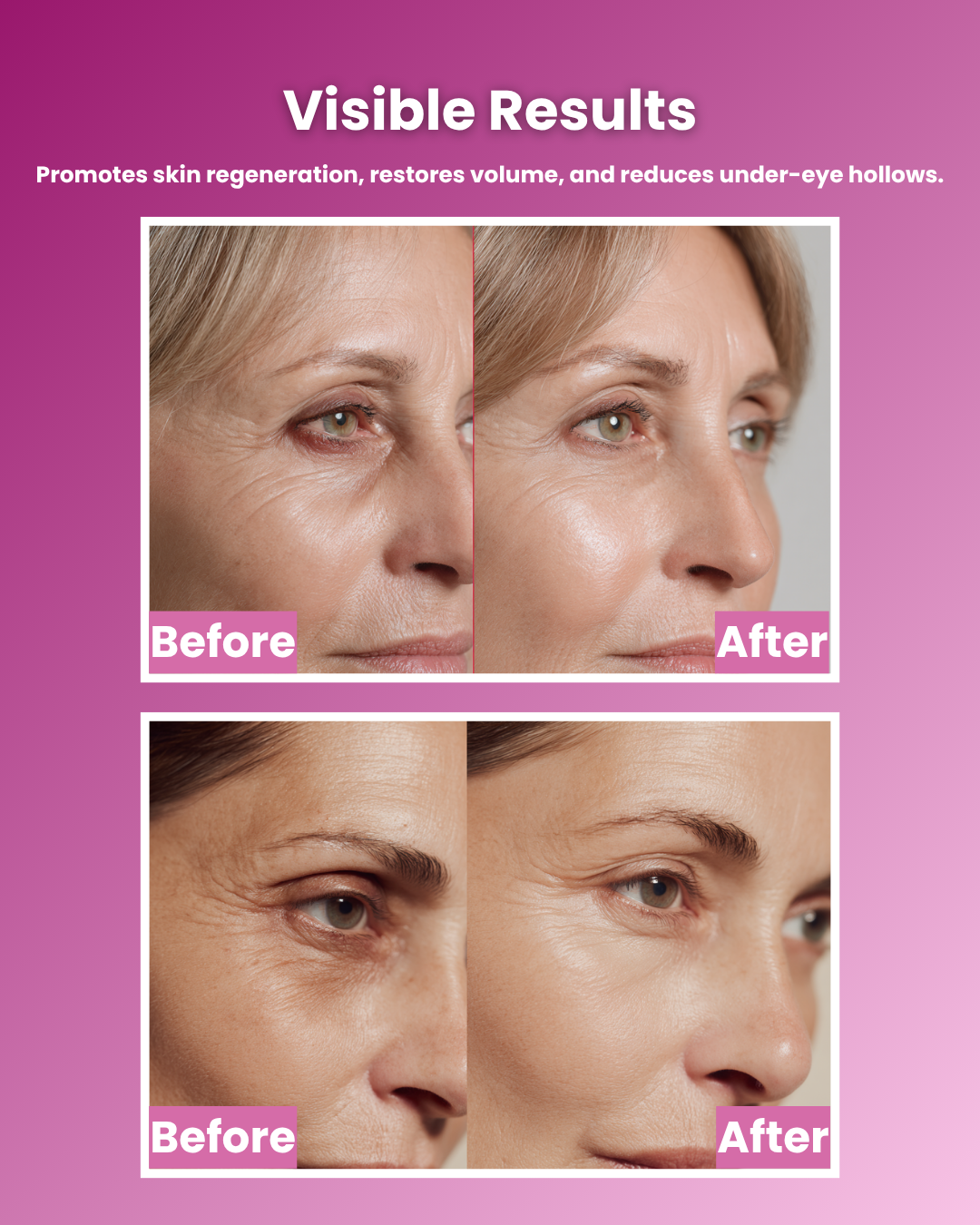 Nerovena Calcium Multi Balm